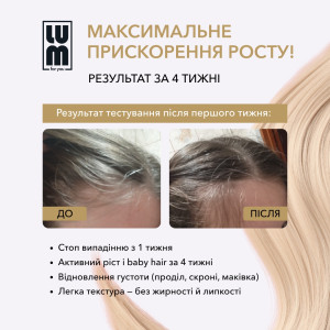 LUM HAIR LOTION ЛОСЬЙОН ДЛЯ ПРИШВИДШЕННЯ РОСТУ ВОЛОССЯ